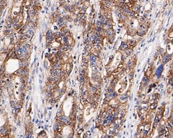 Invitrogen Claudin 18 Polyclonal Antibody 100 &mu;L; Unconjugated:Antibodies,