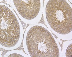 Invitrogen RANBP1 Polyclonal Antibody 100 &mu;L; Unconjugated:Antibodies,