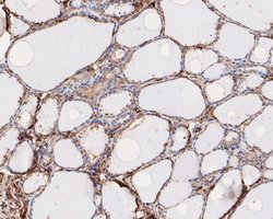 Invitrogen RhoGDI Polyclonal Antibody 100 &mu;L | Buy Online | Invitrogen&trade; | Fisher Scientific