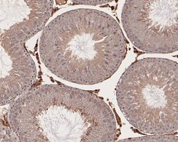 Invitrogen RhoGDI Polyclonal Antibody 100 &mu;L | Buy Online | Invitrogen&trade; | Fisher Scientific