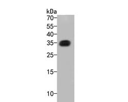 Invitrogen mCherry Polyclonal Antibody 100 &mu;L; Unconjugated:Antibodies,