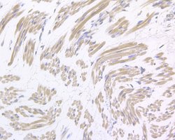 Invitrogen Gemin 2 Polyclonal Antibody 100 &mu;L | Buy Online | Invitrogen&trade; | Fisher Scientific