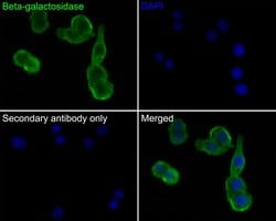 beta Galactosidase Polyclonal Antibody:Antibodies, Polyclonal