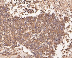 beta Galactosidase Polyclonal Antibody:Antibodies, Polyclonal