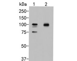 beta Galactosidase Polyclonal Antibody:Antibodies, Polyclonal