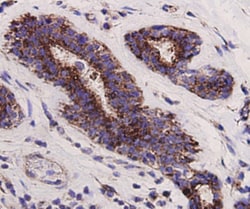 PUMA alpha/beta Polyclonal Antibody:Antibodies, Polyclonal