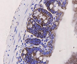 PUMA alpha/beta Polyclonal Antibody:Antibodies, Polyclonal