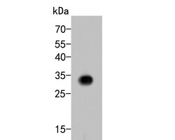 Invitrogen CD8 alpha Polyclonal Antibody 100 &mu;L; Unconjugated:Antibodies,