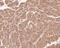 Connexin 26 Polyclonal Antibody 100 &mu;L | Buy Online | Thermo Scientific | Fisher Scientific