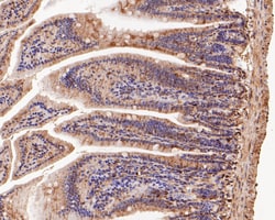 Connexin 26 Polyclonal Antibody 100 &mu;L | Buy Online | Thermo Scientific | Fisher Scientific