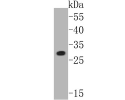Connexin 26 Polyclonal Antibody 100 &mu;L | Buy Online | Thermo Scientific | Fisher Scientific
