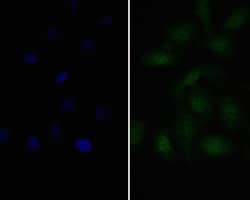 Invitrogen PAX8 Polyclonal Antibody 100 &mu;L; Unconjugated:Antibodies,