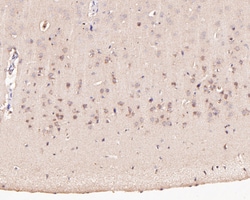 Pannexin 2 Polyclonal Antibody:Antibodies, Polyclonal