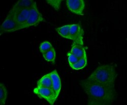 Cytokeratin 19 Polyclonal Antibody:Antibodies, Polyclonal
