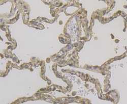 Cytokeratin 19 Polyclonal Antibody:Antibodies, Polyclonal