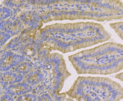 Cytokeratin 19 Polyclonal Antibody:Antibodies, Polyclonal