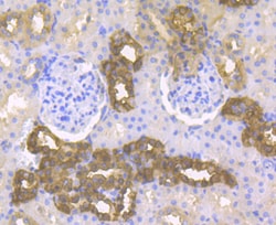 Cytokeratin 19 Polyclonal Antibody:Antibodies, Polyclonal