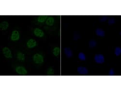 Invitrogen delta Catenin Polyclonal Antibody 100 μL; Unconjugated:Antibodies,