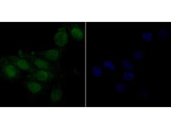 Invitrogen delta Catenin Polyclonal Antibody 100 μL; Unconjugated:Antibodies,