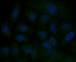 Invitrogen IP3 Receptor 2 Polyclonal Antibody 100 &mu;L; Unconjugated:Antibodies,