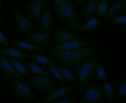 Invitrogen IP3 Receptor 2 Polyclonal Antibody 100 &mu;L; Unconjugated:Antibodies,