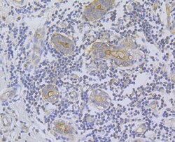 Invitrogen IP3 Receptor 2 Polyclonal Antibody 100 &mu;L; Unconjugated:Antibodies,