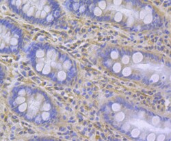 Invitrogen IP3 Receptor 2 Polyclonal Antibody 100 &mu;L; Unconjugated:Antibodies,