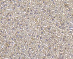 Invitrogen IP3 Receptor 2 Polyclonal Antibody 100 &mu;L; Unconjugated:Antibodies,