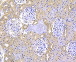 Invitrogen IP3 Receptor 2 Polyclonal Antibody 100 &mu;L; Unconjugated:Antibodies,