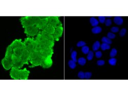Invitrogen p16INK4a Polyclonal Antibody 100 μL; Unconjugated:Antibodies,