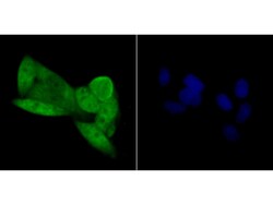 Invitrogen p16INK4a Polyclonal Antibody 100 μL; Unconjugated:Antibodies,