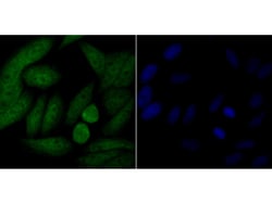 Invitrogen p16INK4a Polyclonal Antibody 100 μL; Unconjugated:Antibodies,