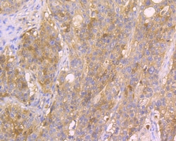 Invitrogen p16INK4a Polyclonal Antibody 100 μL; Unconjugated:Antibodies,