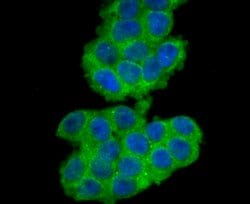 Invitrogen B7-H3 (CD276) Polyclonal Antibody 100 &mu;L; Unconjugated:Antibodies,