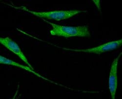 Invitrogen B7-H3 (CD276) Polyclonal Antibody 100 &mu;L; Unconjugated:Antibodies,