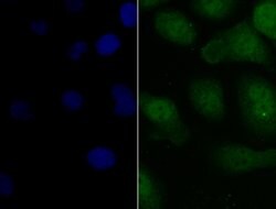 Invitrogen PAX8 Polyclonal Antibody 100 &mu;L; Unconjugated:Antibodies,