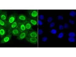 Invitrogen APE1 Polyclonal Antibody 100 &mu;L; Unconjugated:Antibodies,
