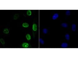 Invitrogen APE1 Polyclonal Antibody 100 &mu;L; Unconjugated:Antibodies,