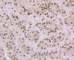 Invitrogen APE1 Polyclonal Antibody 100 &mu;L; Unconjugated:Antibodies,