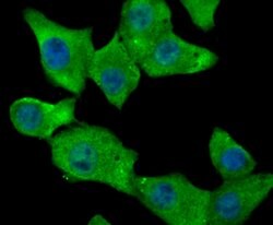 Invitrogen Fibrinogen Polyclonal Antibody 100 &mu;L; Unconjugated:Antibodies,