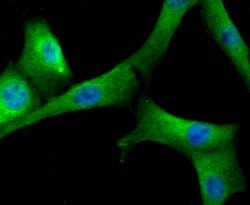 Invitrogen Fibrinogen Polyclonal Antibody 100 &mu;L; Unconjugated:Antibodies,