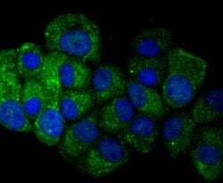 Invitrogen Osteopontin Polyclonal Antibody 100 &mu;L | Buy Online | Invitrogen&trade; | Fisher Scientific