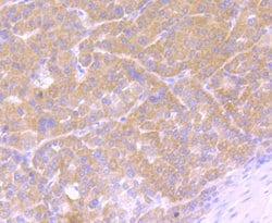 Invitrogen Osteopontin Polyclonal Antibody 100 &mu;L | Buy Online | Invitrogen&trade; | Fisher Scientific