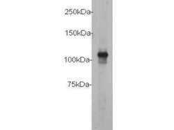 Invitrogen c-Myc Polyclonal Antibody, HRP 100 &mu;L | Buy Online | Invitrogen&trade; | Fisher Scientific