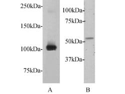 Invitrogen c-Myc Polyclonal Antibody 100 &mu;L; Unconjugated:Antibodies,