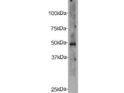 Invitrogen CELSR2 Polyclonal Antibody 100 &mu;L; Unconjugated:Antibodies,