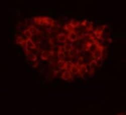 Invitrogen FAT4 Polyclonal Antibody 100 &mu;L; Unconjugated:Antibodies,