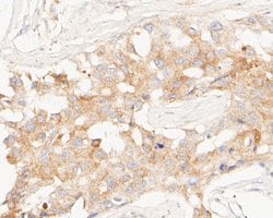 Invitrogen TMEM67 Polyclonal Antibody 100 &mu;L; Unconjugated:Antibodies,