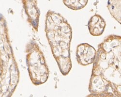 Invitrogen TMEM67 Polyclonal Antibody 100 &mu;L; Unconjugated:Antibodies,
