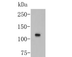 Invitrogen TMEM67 Polyclonal Antibody 100 &mu;L; Unconjugated:Antibodies,